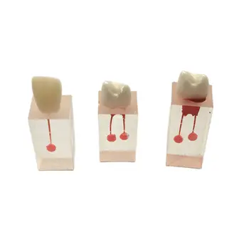 Vendas M8004 Endo Formação de Bloco Dentário Ensino Dentes Modelo para a Formação