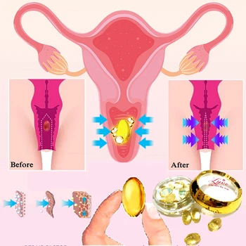Vagina Estreita Aperto Dan Para A Mulher Cápsula Vaginal Aperto De Cuidados Privados Vagina Encolhimento De Higiene Feminina De Reparação Dan